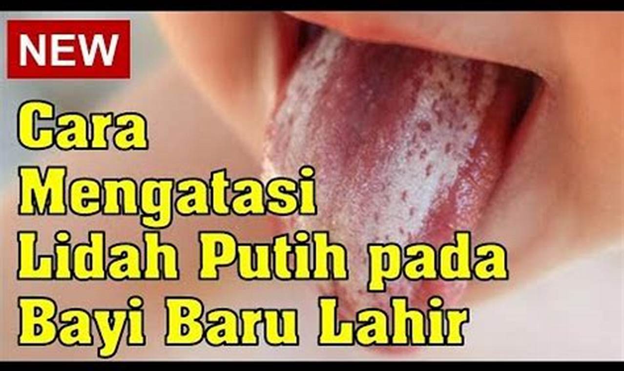 cara mengatasi lidah putih